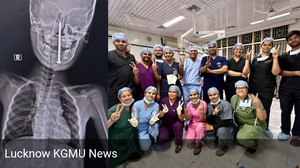 Lucknow KGMU News
